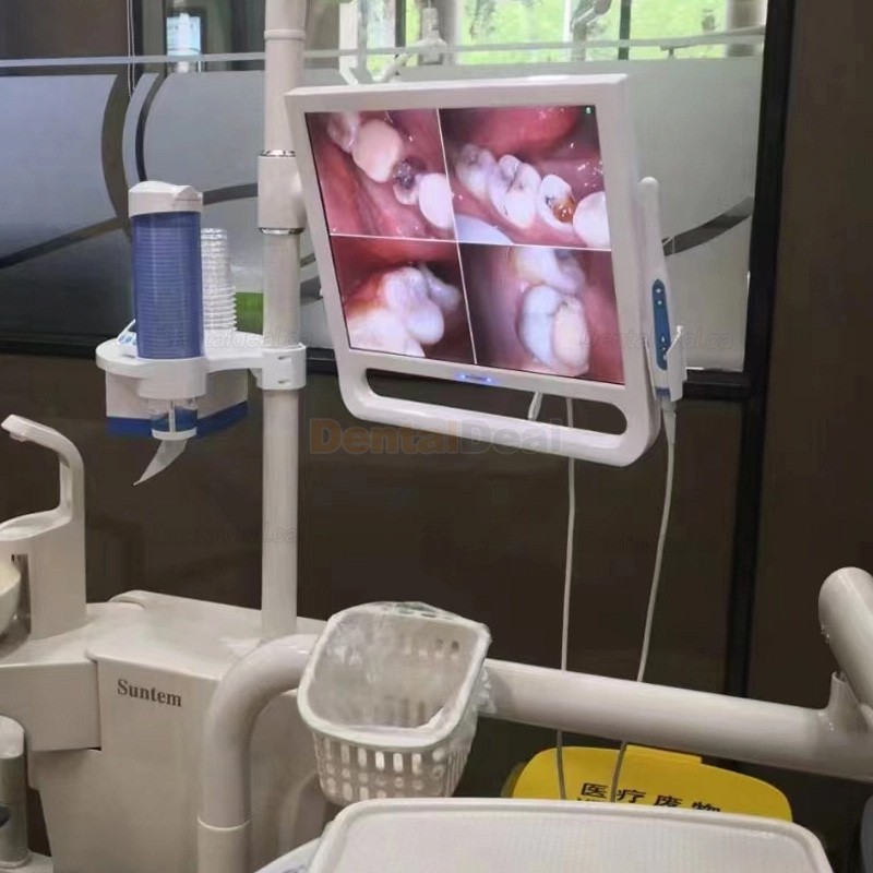 Magenta YF1700M Intraoral Camera with 17 Inch Screen & WIFI